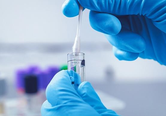核酸檢測是用棉簽沾一下就行了嗎?核酸檢測多久出結果?