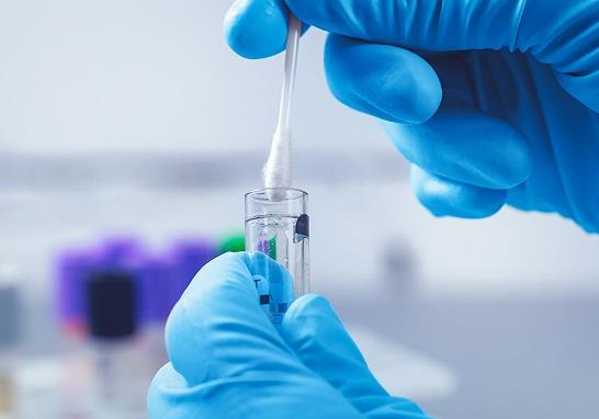 核酸檢測是不是在哪個小區(qū)都可以做?什么時候都可以做核酸檢測嗎?