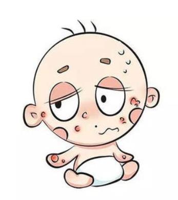 過敏體質不能吃什么?吃什么可以改善過敏體質?