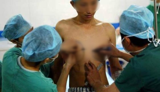 藥娘吃糖是什么意思 藥娘和人妖變性的區別 藥娘吃什么激素藥變性