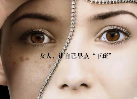 經(jīng)期延長引發(fā)黃褐斑怎么辦？如何預(yù)防黃褐斑