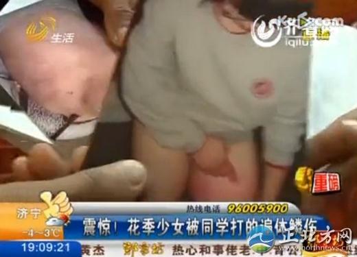 16歲花季少女被四名室友毆打4小時，脫光了跪在地上打，打得遍體鱗傷