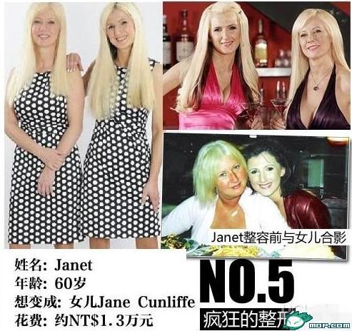 坑爹時(shí)代：那些奇葩的瘋狂變臉整容，坑爹呀