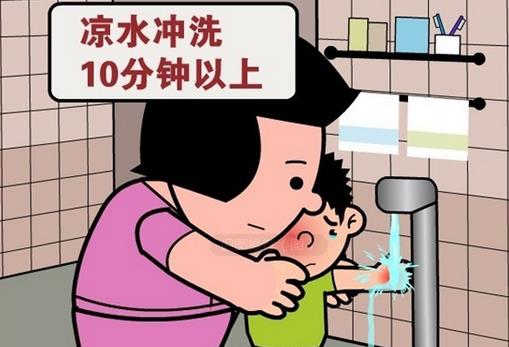 被開水燙傷怎么辦？應急措施介紹