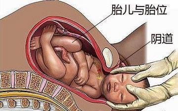 【分娩】分娩注意什么_分娩前的征兆_分娩視頻全過程_分娩后吃什么補身體