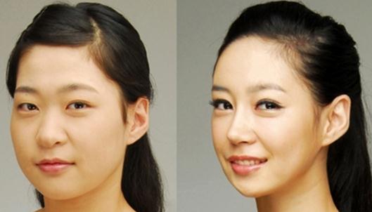 咬肌瘦臉針有什么危害？