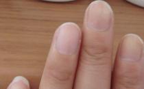 男人腎虛有哪些表現 看手指辨疾病