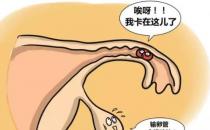 輸卵管妊娠的自我檢查、癥狀及治療方法