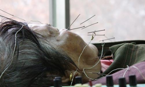 警惕！氣溫驟變，多人中招口眼歪斜、面部麻木……此季高