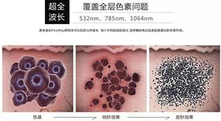 寧波薇琳整形醫院祛斑怎么樣？還您一張漂亮的容顏