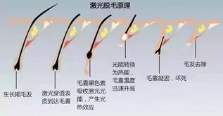 寧波薇琳整形醫院祛斑怎么樣？還您一張漂亮的容顏