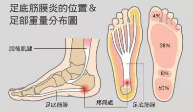 湛江崇愛康復醫院科普如何防治肌筋膜炎 以真誠來服務患者