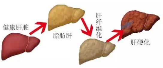 貴州治丙肝醫(yī)院靠不靠譜 貴州中醫(yī)肝病醫(yī)院質量醫(yī)療的踐行者