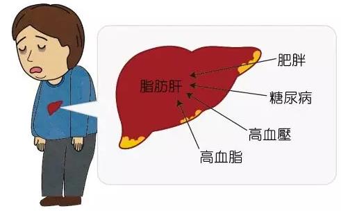 貴州治丙肝醫(yī)院靠不靠譜 貴州中醫(yī)肝病醫(yī)院質量醫(yī)療的踐行者