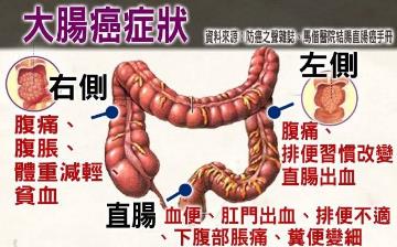 【大腸癌】早期腸癌自檢方法及早期信號癥狀_什么樣的腹痛是腸癌
