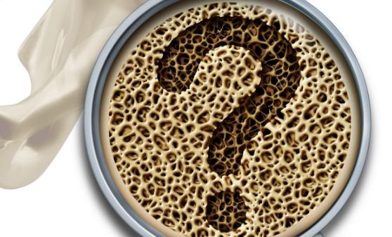 骨質疏松的10個認知誤區，你中了沒？