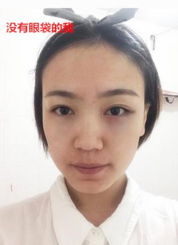 衛(wèi)婭日記：我一直都以為眼袋對(duì)我的影響只是美觀，直到我了解了以后……