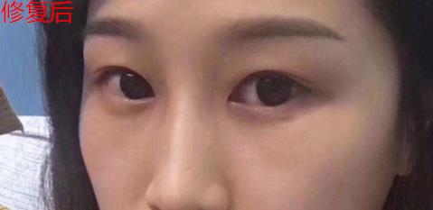 衛(wèi)婭日記：我一直都以為眼袋對(duì)我的影響只是美觀，直到我了解了以后……