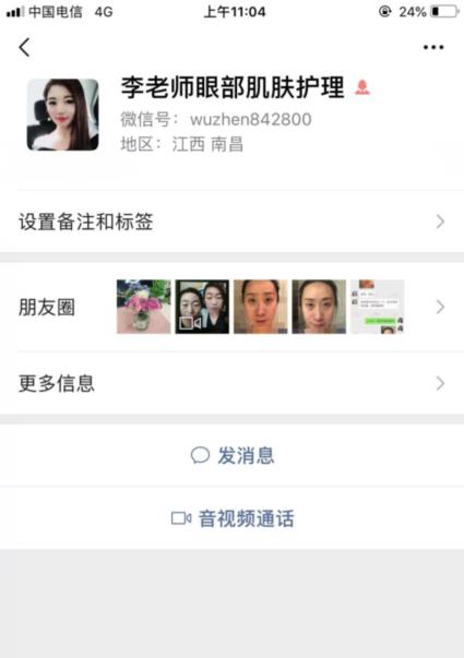 君雅筆記：眼袋過重，就會(huì)顯得比真實(shí)年齡大，要如何修復(fù)眼袋呢？