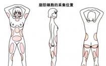 韋元強：產后能做自體脂肪豐胸嗎？