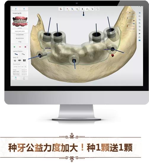 中家醫(yī)口腔全民愛牙公益行動：德國智能種植牙更靠譜