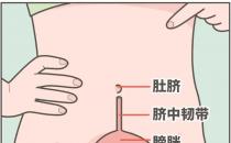 ?肚臍下面疼是怎么回事，肚臍下面疼是怎么回事男性